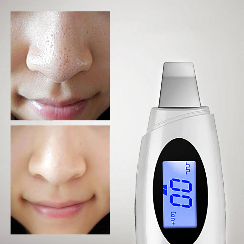 Ultrasonic beauty instrument in star silver with adjustable vibration frequency and plug charger