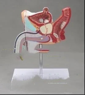 Anatomical model of male reproductive system showing pathologies like benign prostatic hyperplasia