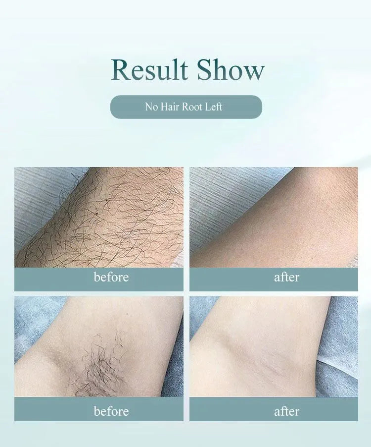Compact laser hair removal handset in dark green with 8 power levels and skin rejuvenation