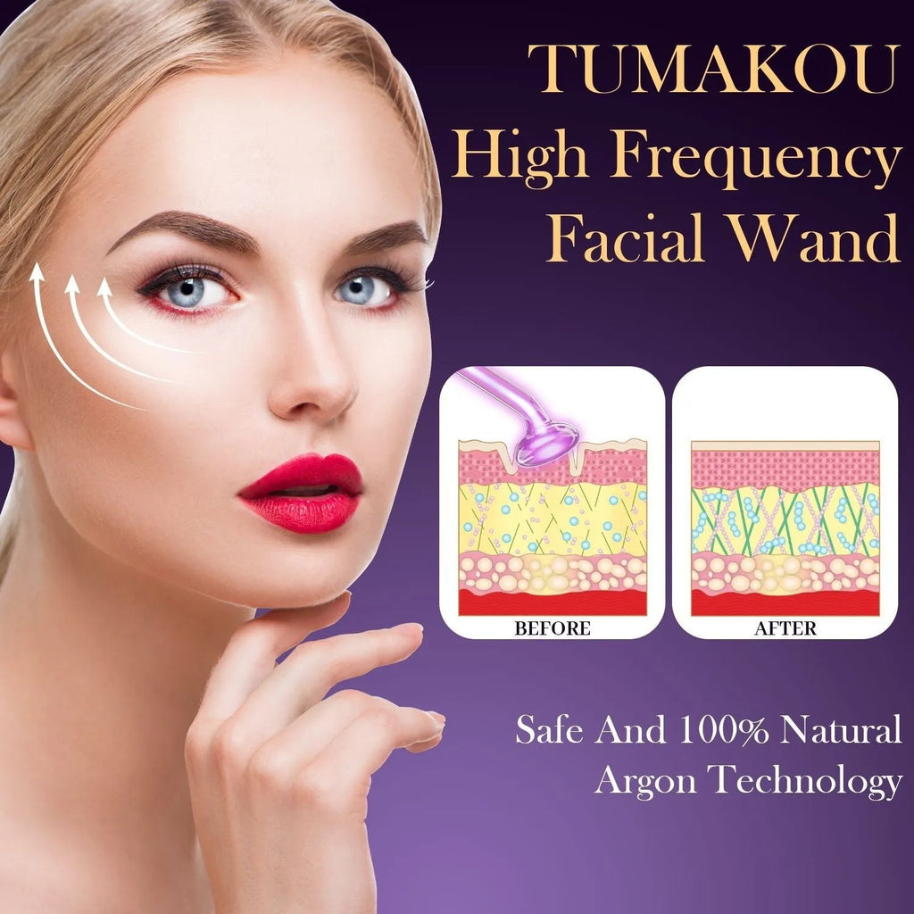 Purple high wave electrotherapy rod with six accessory heads for skin rejuvenation treatments