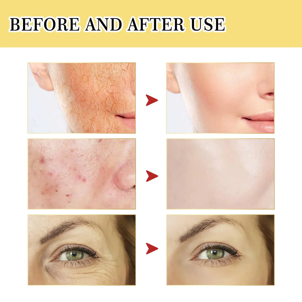 Snail serum collagen facial serum bottle 100ml volume with original formulation for skin hydration and brightening