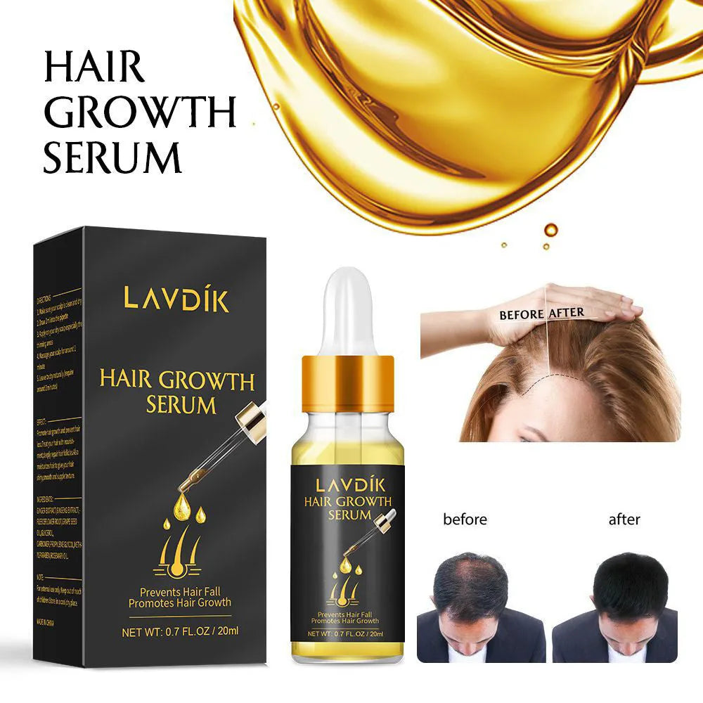 20ml hair growth essence oil bottle with ginger and ginseng extract for scalp application and hair loss care