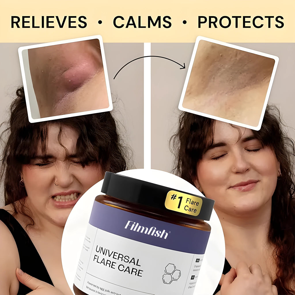 Keep Skin Calm Repair Factor Tea Tree Body Repair Cream in a 141g tub