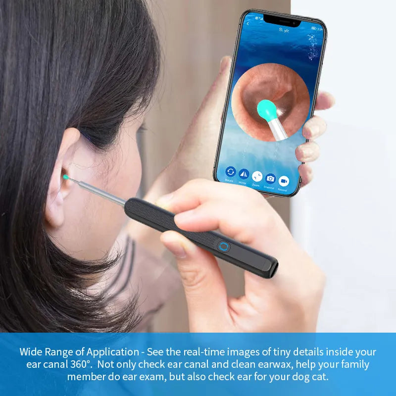 NE3 wireless ear cleaner otoscope with camera, charging cable, and spoon heads on a white background.