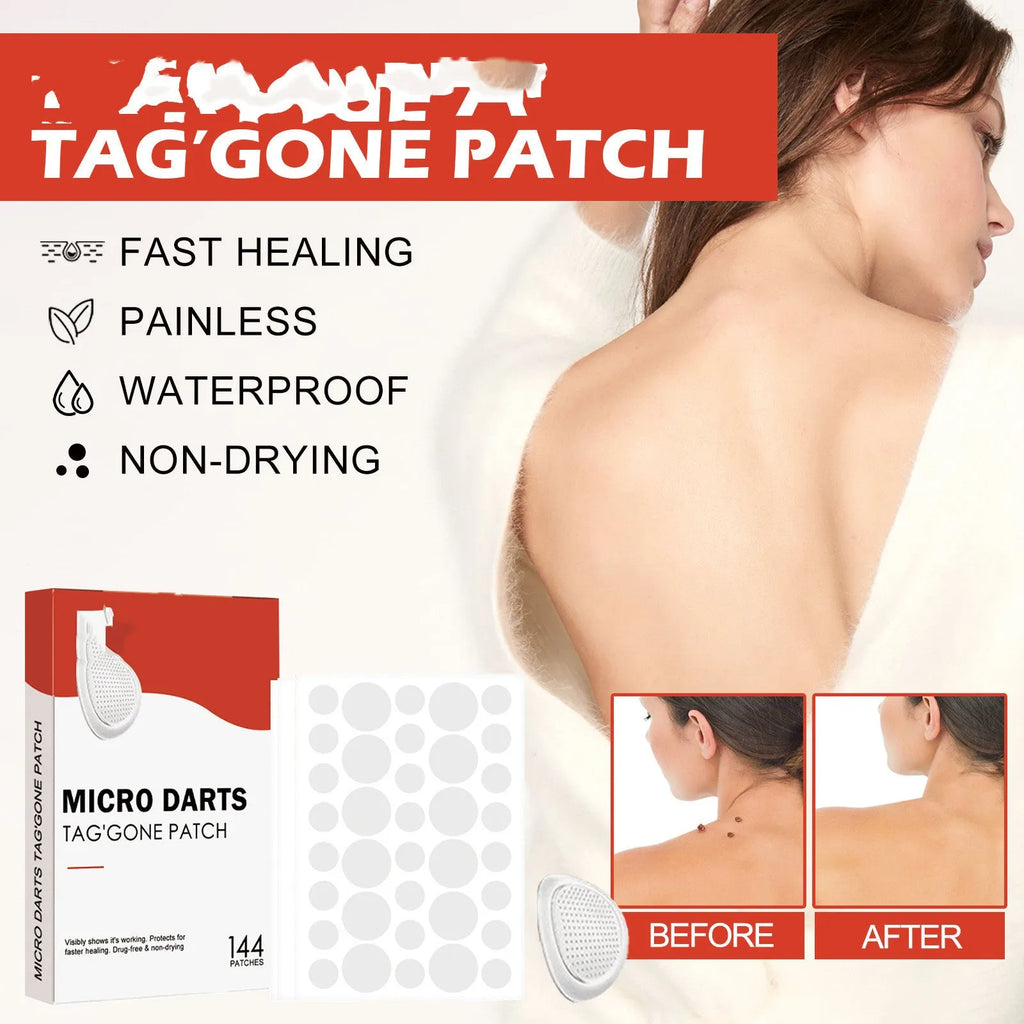 Box of 144 acne patches with tea tree oil and calendula oil for spot treatment