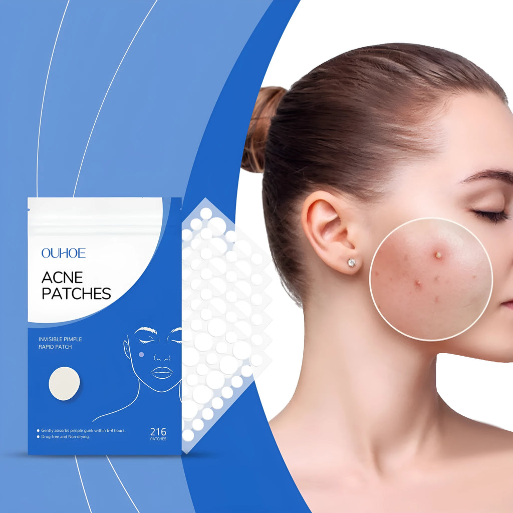 216 acne patches with tea tree oil and vitamin E formulation for facial blemish treatment