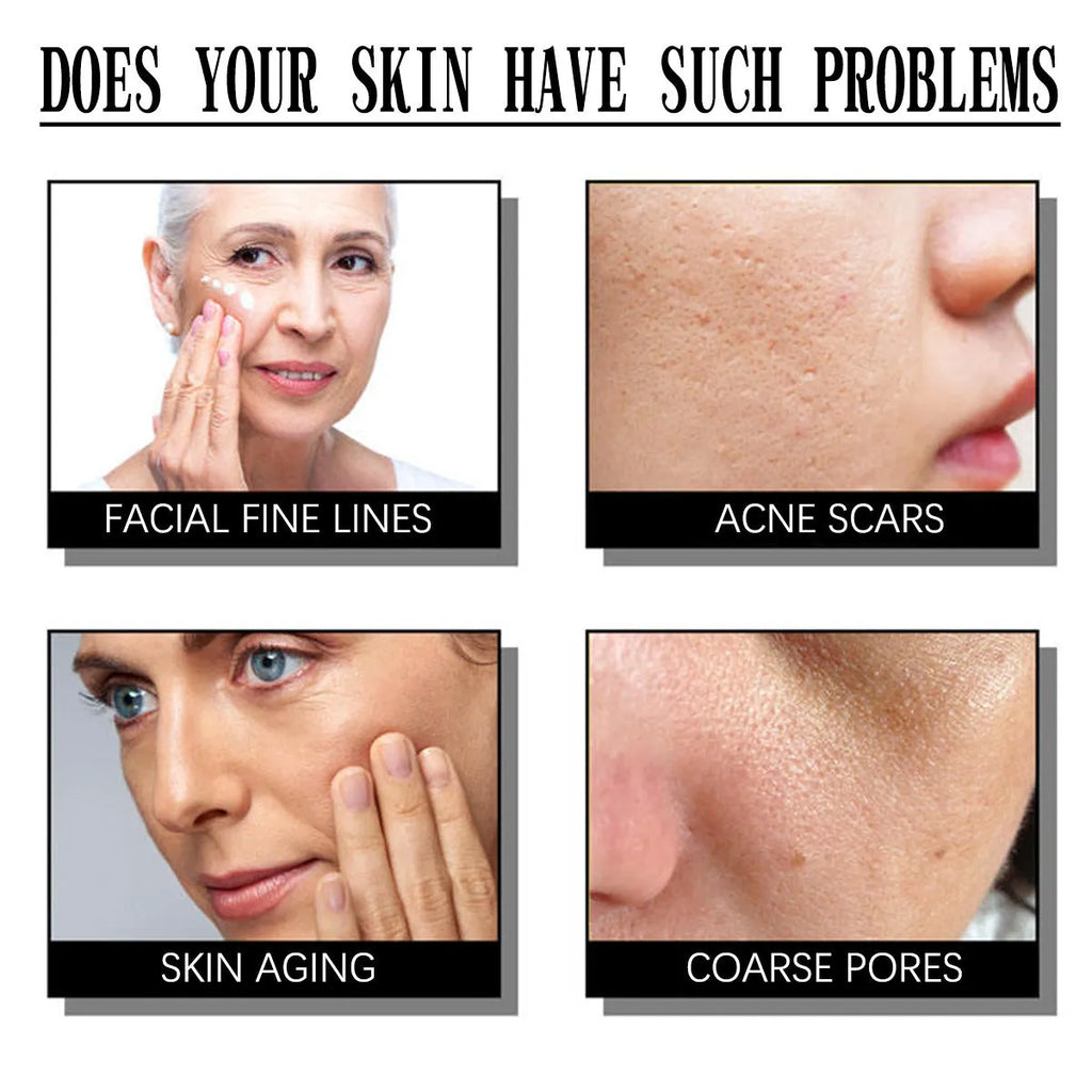 50g salicylate exfoliating moisturising cream for general skin care use
