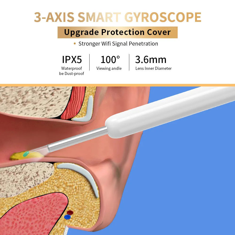NE3 wireless ear cleaner otoscope with camera, charging cable, and spoon heads on a white background.