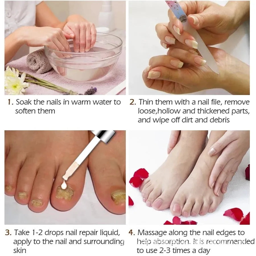 Jiagou Repair Dust For Deck Liquid Antimicrobial foot treatment bottle 10ml