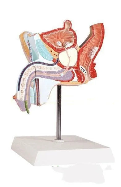 Anatomical model of male reproductive system showing pathologies like benign prostatic hyperplasia