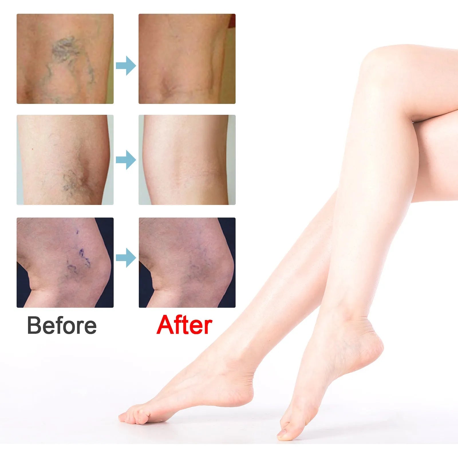 20g tube of green botanical vein repair cream for leg bulge and visible veins
