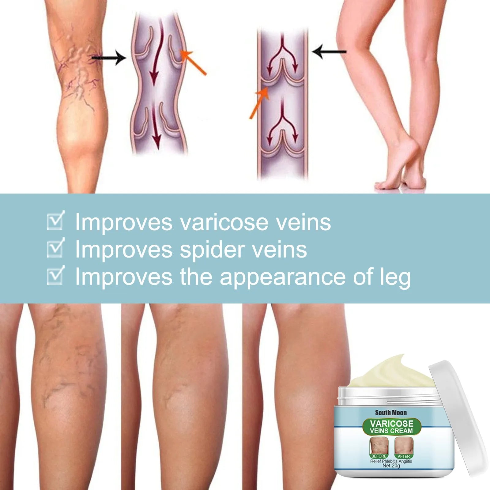20g tube of green botanical vein repair cream for leg bulge and visible veins