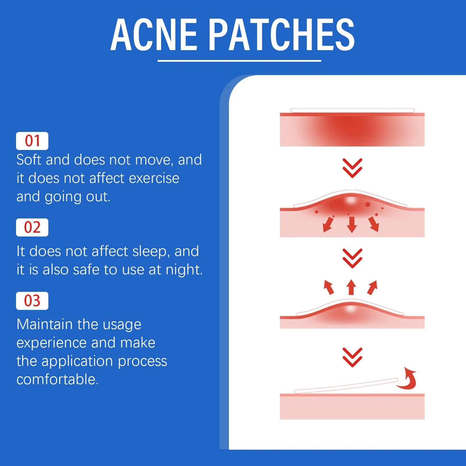 216 acne patches with tea tree oil and vitamin E formulation for facial blemish treatment