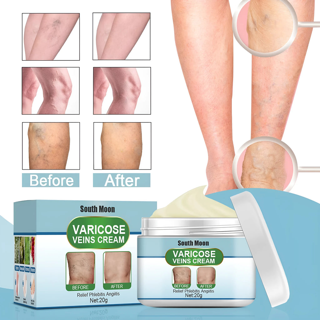 20g tube of green botanical vein repair cream for leg bulge and visible veins
