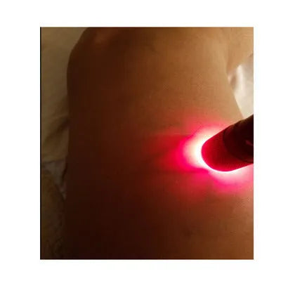 Black aluminium alloy smart vein locator medical device showing red LED illumination for vein detection