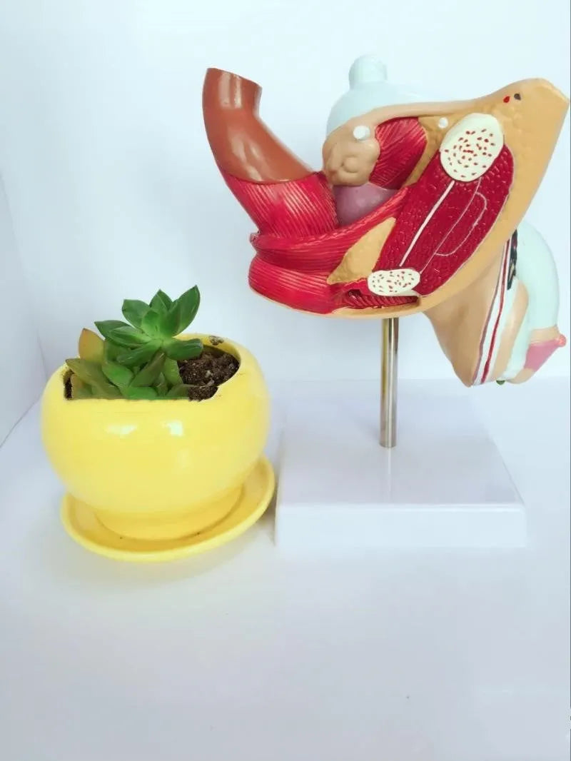 Anatomical model of male reproductive system showing pathologies like benign prostatic hyperplasia
