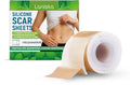 Roll of silicone scar sheet showing 4cm width with tea tree oil and aloe extract for scar management