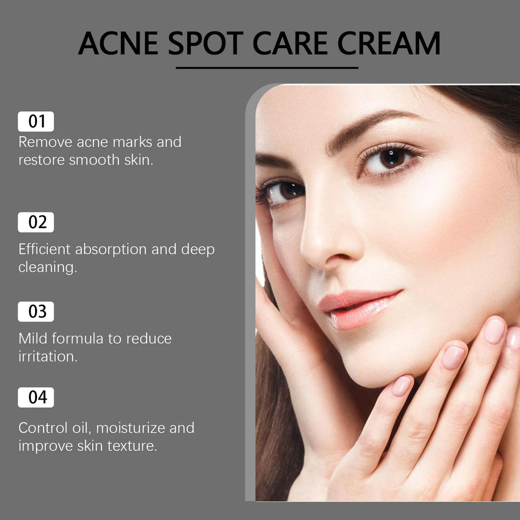 15g jar of hydrating acne cream with mint, tea tree oil and aloe ingredients