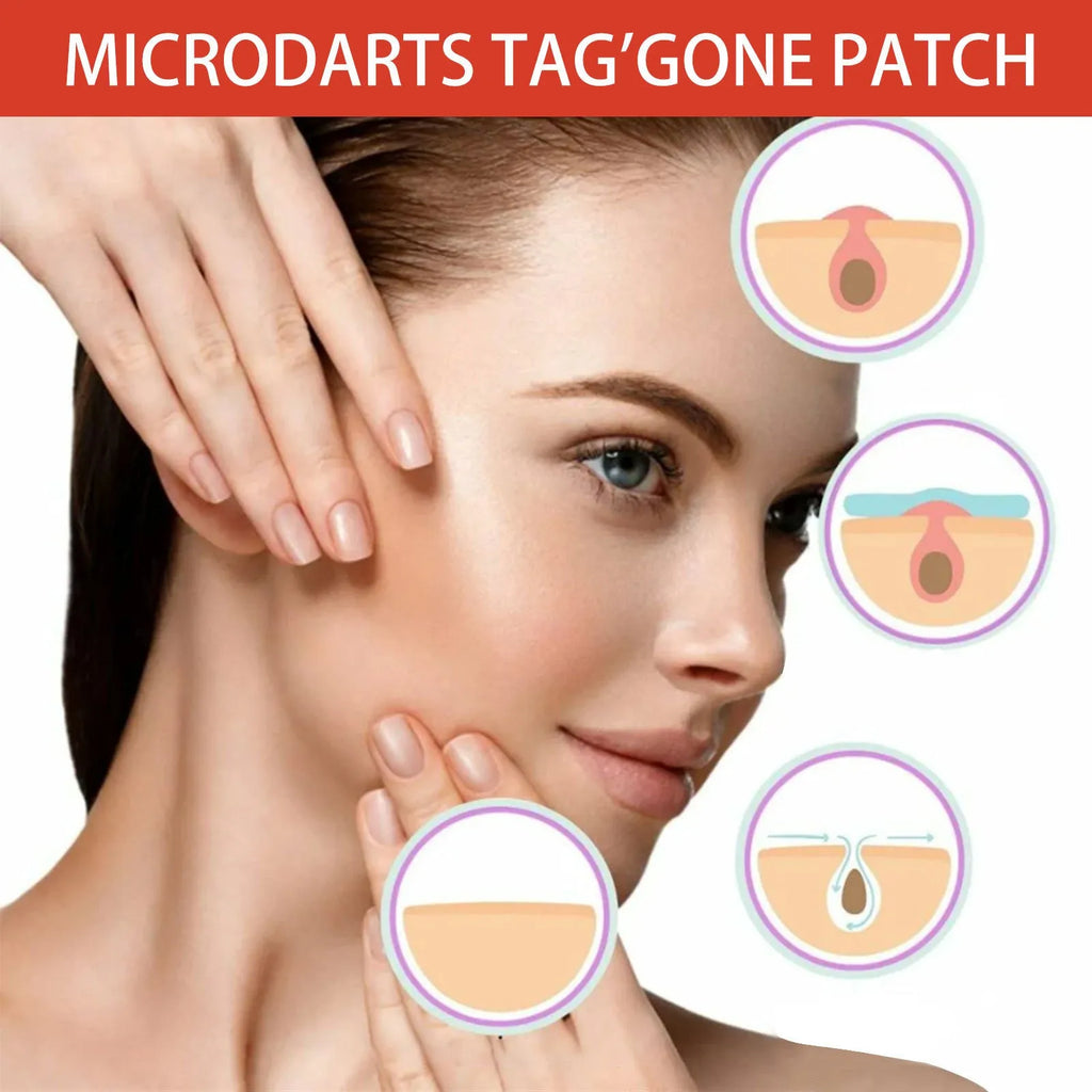 Box of 144 acne patches with tea tree oil and calendula oil for spot treatment