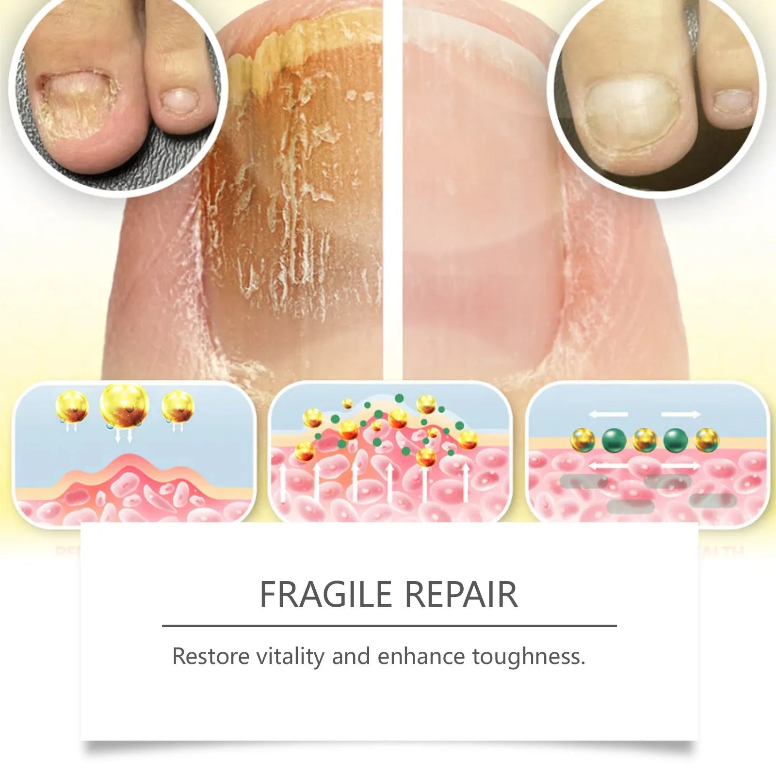 50ml bottle of nail fungus care solution with bee venom and peppermint oil