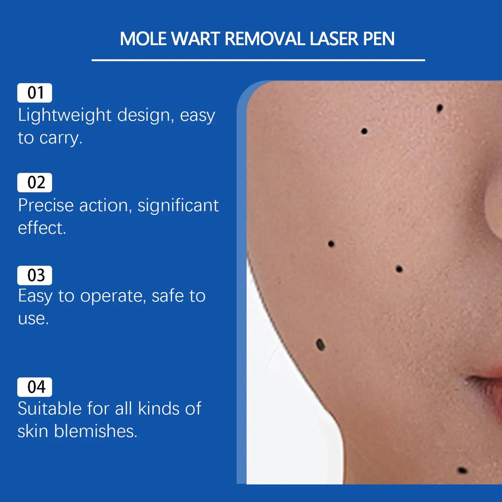 Close-up of a white ABS plastic mole wart removal laser pen held in hand.