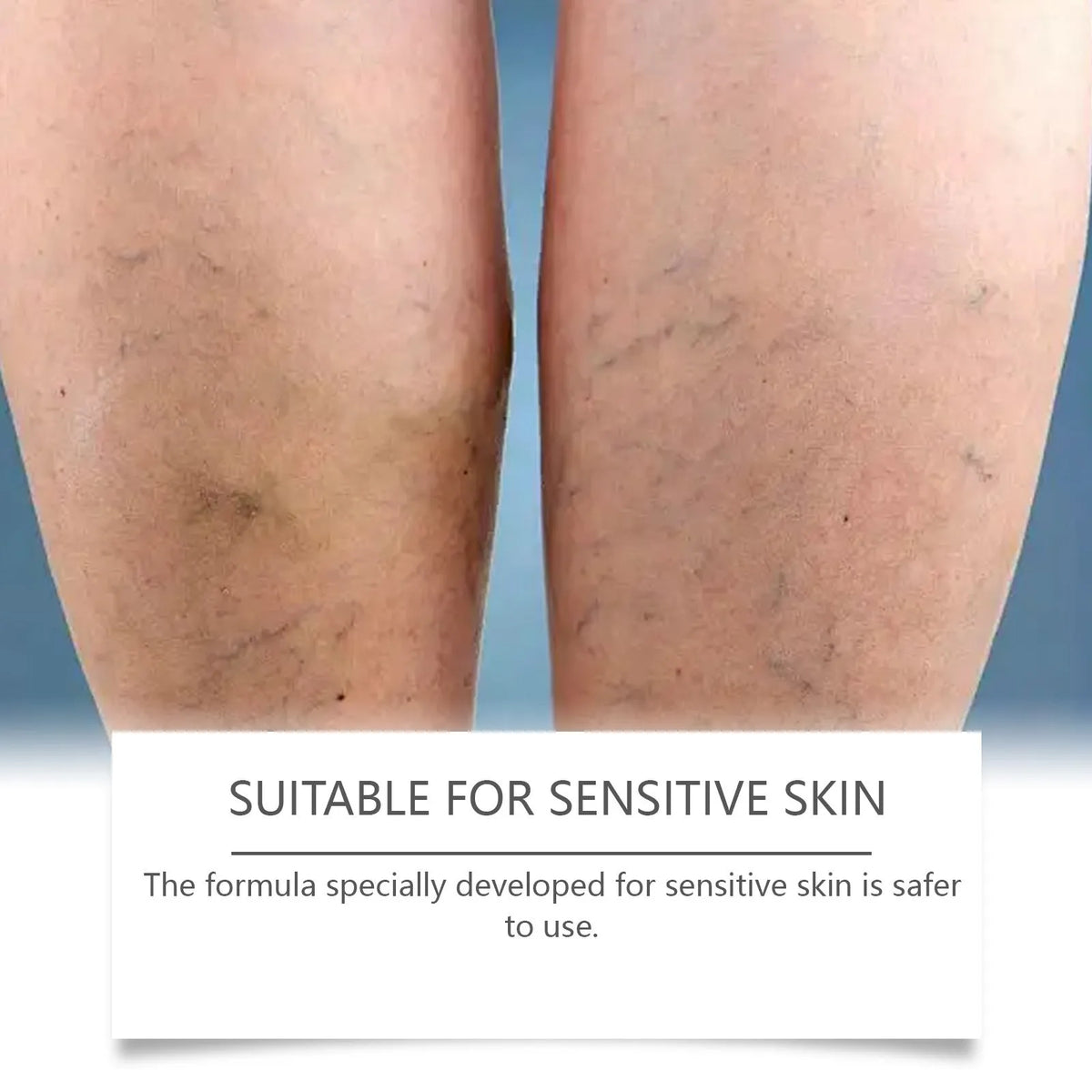 20g tube of leg massage ointment with mint, arnica, witch hazel, vitamin B6, and aloe