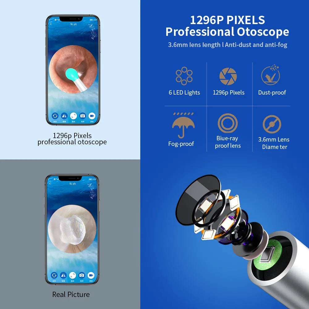 NE3 wireless ear cleaner otoscope with camera, charging cable, and spoon heads on a white background.